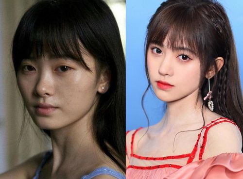 整容前后比较，整形前后效果图(整容手术前后对比照片)