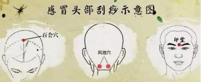 ​感冒刮痧(感冒刮痧刮哪里好得快)