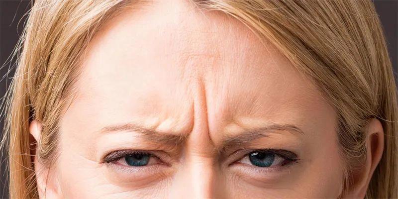 面部有川字纹怎么办（川字纹消除的方法）