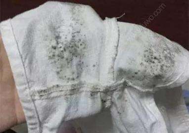 衣服发霉怎么洗掉霉斑黑点,衣服发霉用什么洗掉霉斑图9