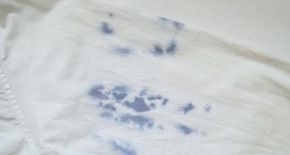 衣服发霉怎么洗掉霉斑黑点,衣服发霉用什么洗掉霉斑图7