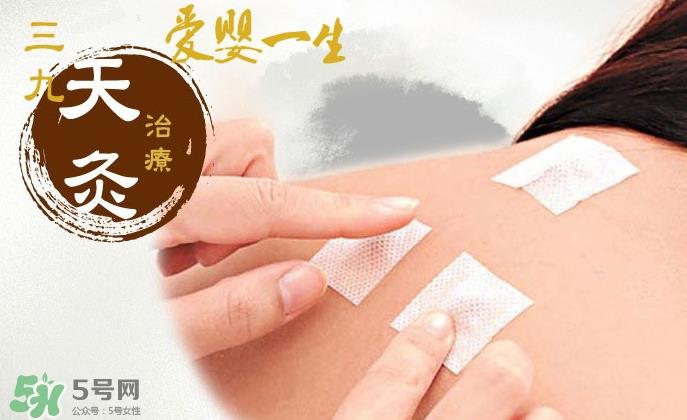 三伏贴和三九贴的区别 三伏贴和三九贴的作用