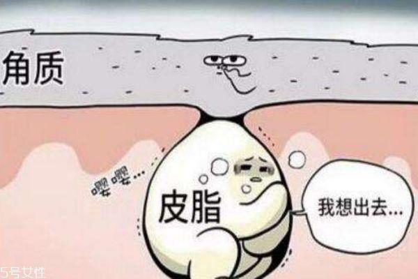 如何去除下巴上的粉刺 清洁补水控油三部曲 如何去除下巴上的粉刺 清洁补水控油三部曲