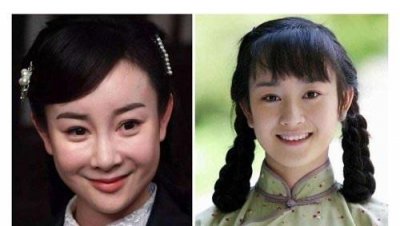 ​张檬整容记图片判若两人 变化好大而且整残了