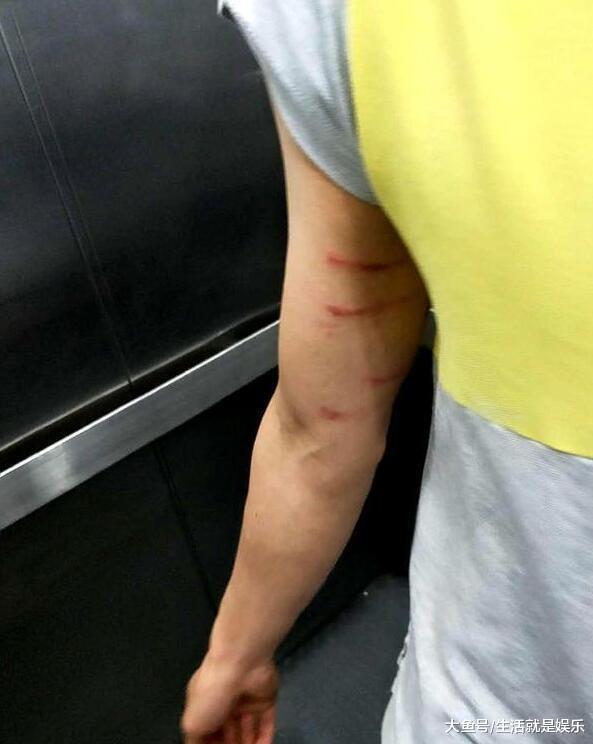 高考结束当晚, 班主任被学生家长一顿毒打, 三岁女儿被打到呕吐