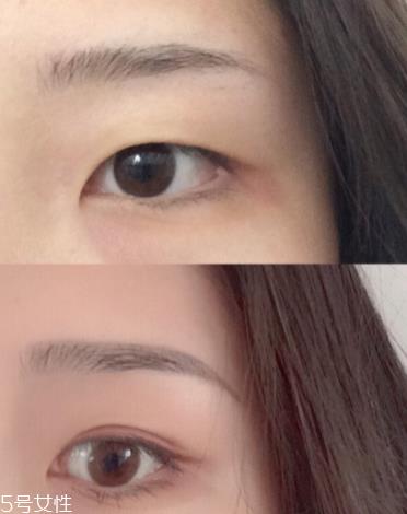 双眼皮贴可以用什么代替 双眼皮贴可以用什么代替