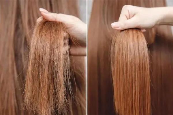 干性头发会变成油性头发吗 干性头发会导致头皮屑吗 干性头发会变成油性头发吗 干性头发会导致头皮屑吗