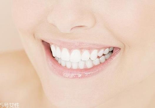 磨砂牙膏有什么好处 清除牙垢好帮手 磨砂牙膏有什么好处 清除牙垢好帮手