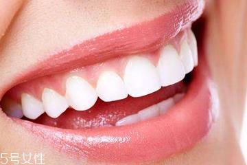 磨砂牙膏有什么好处 清除牙垢好帮手 磨砂牙膏有什么好处 清除牙垢好帮手