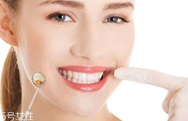 磨砂牙膏有什么好处 清除牙垢好帮手 磨砂牙膏有什么好处 清除牙垢好帮手