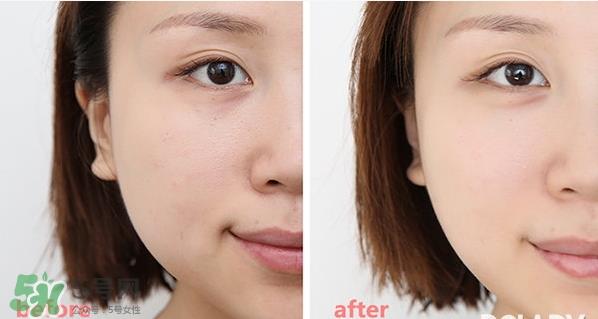 wellage唯拉珠维他注射面膜怎么用_使用方法 wellage唯拉珠维他注射面膜怎么用_使用方法