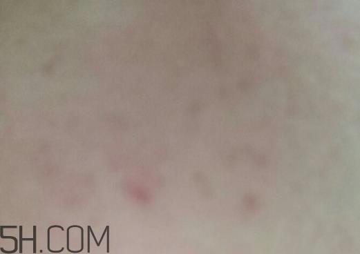 aox suaox祛痘原液怎么样？多少钱？