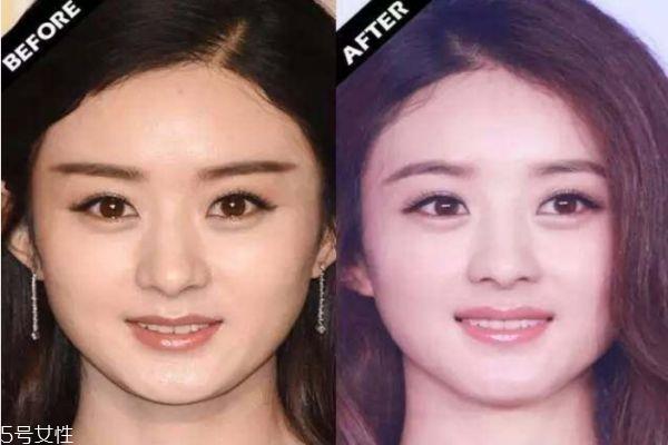 额头窄适合什么眉形 额头窄适合的眉形 额头窄适合什么眉形 额头窄适合的眉形