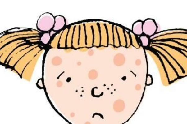 青春痘有哪几种类型 青春痘有脓包怎么办 青春痘有哪几种类型 青春痘有脓包怎么办