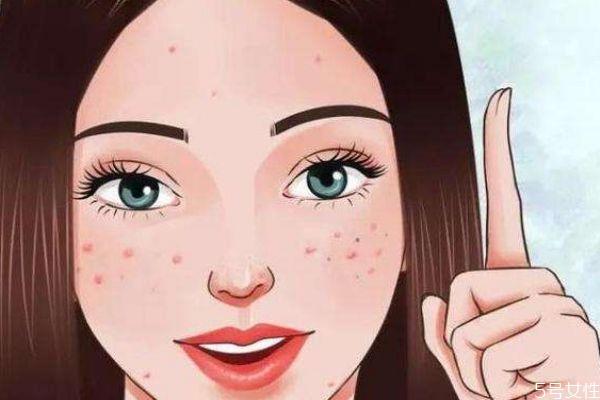 为什么脸上会长包呢 长包的原因是什么呢 为什么脸上会长包呢 长包的原因是什么呢