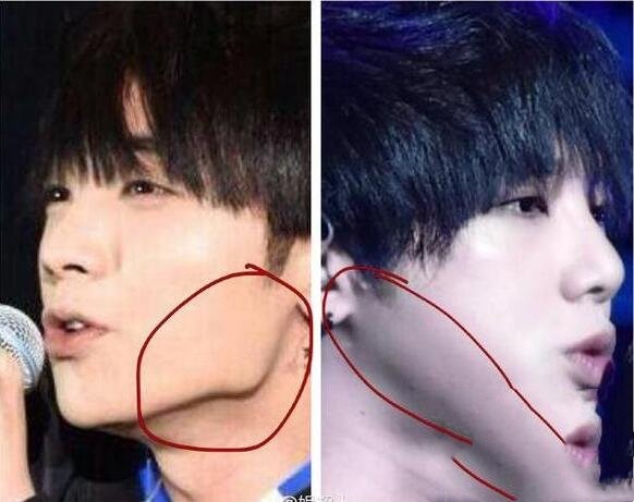 华晨宇整容前样子(整容后变成了权志龙惊悚)(3)_