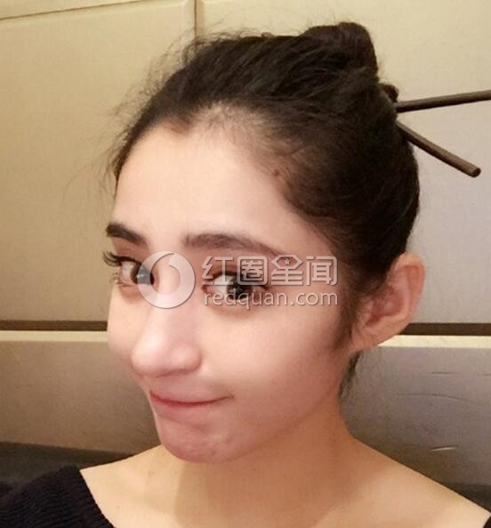 李心艾被潜规则真相 李心艾有没有整容