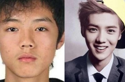 ​“”明星整容”前后对比！鹿晗！兴艺！肖战！