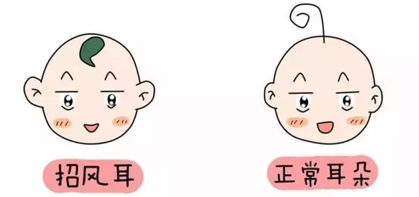 为什么很多明星都是招风耳(什么是招风耳图片)  第5张