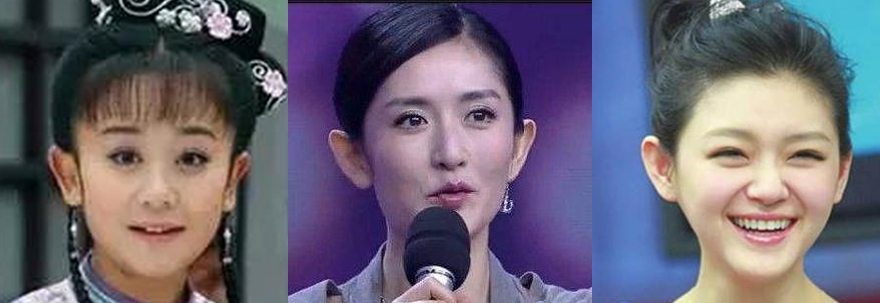 为什么很多明星都是招风耳(什么是招风耳图片)  第1张