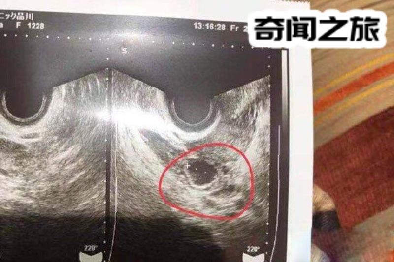 蒋劲夫家暴女友的原因（和很多男性友人一起去夜店玩）(1)_