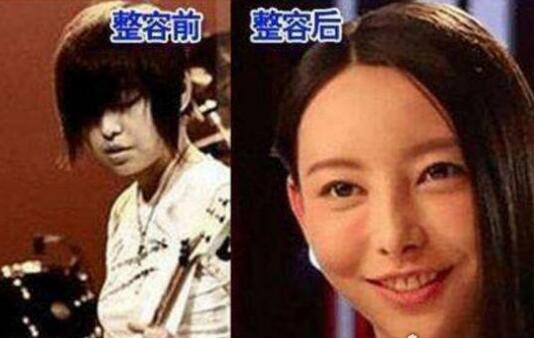 于文文为什么叫整容女神?于文文是歌手还是 于文文为什么叫整容女神?于文文是歌手还是