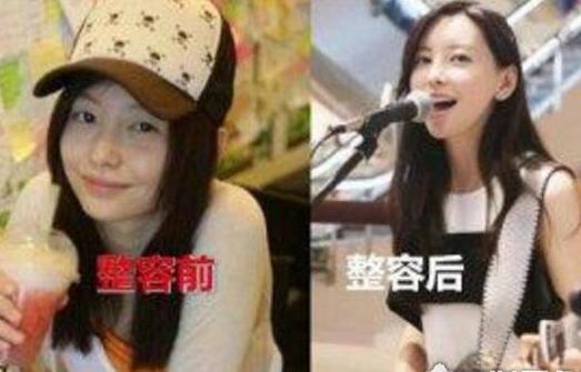 于文文为什么叫整容女神?于文文是歌手还是 于文文为什么叫整容女神?于文文是歌手还是