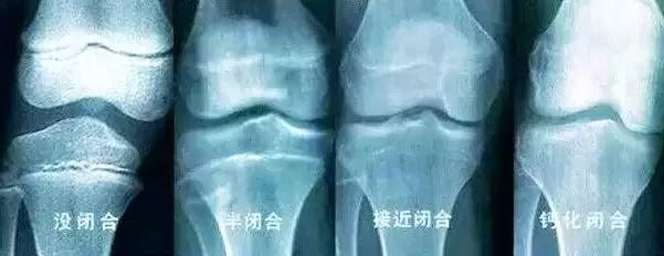 生长激素想用就用？徐璇医生教你全面认识生长激素！