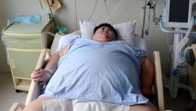 ​“中国第一胖”孙亮的最后时光