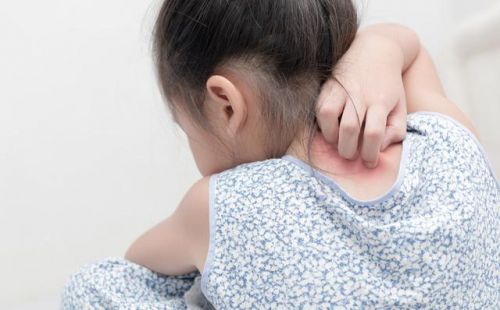 牛皮有癣用什么药好,不含激素？专治牛皮皮癣药膏癣立净-第1张图片-