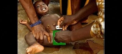 ​以色列的割礼：传统仪式背后的重要含义